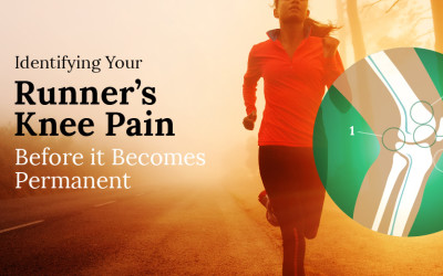 Runner’s Guide to Identifying Your Knee Pain And When to See a Doctor