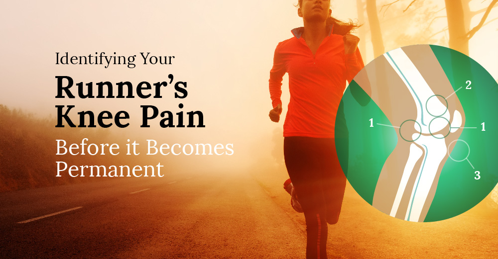Runner’s Guide to Identifying Your Knee Pain And When to See a Doctor