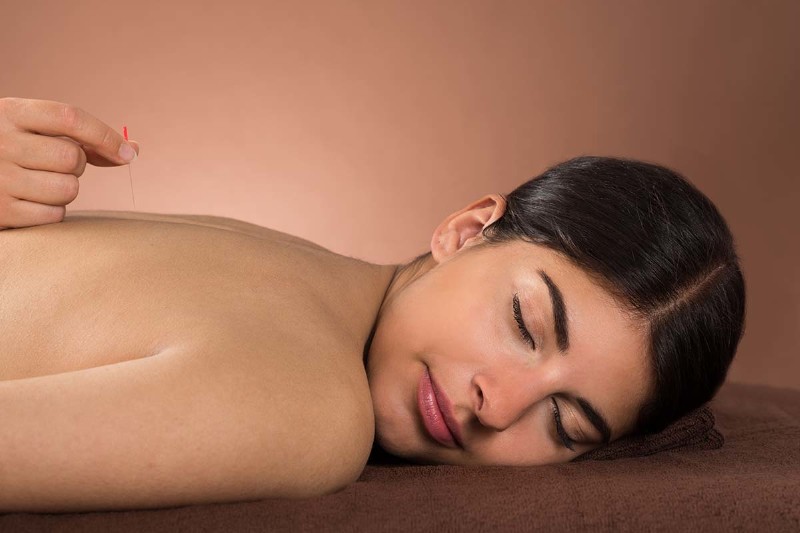  What to Expect During Your Acupuncture Treatment