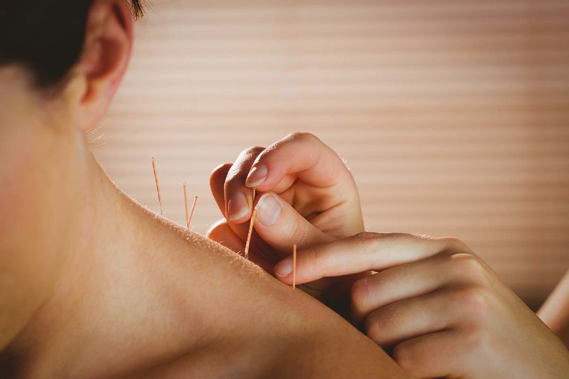  What is Acupuncture and How Does it Work?